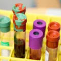 blood biomarkers and exceptional longevity