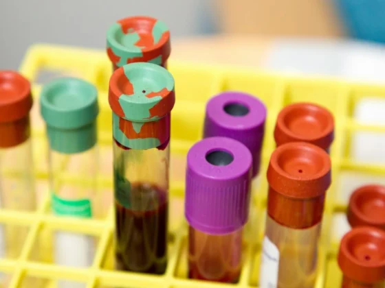 blood biomarkers and exceptional longevity